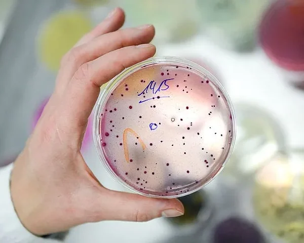 Procedura autocontrol restaurant